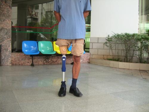 假肢是怎么装在腿上的正确穿戴大腿假肢的方法(图1)